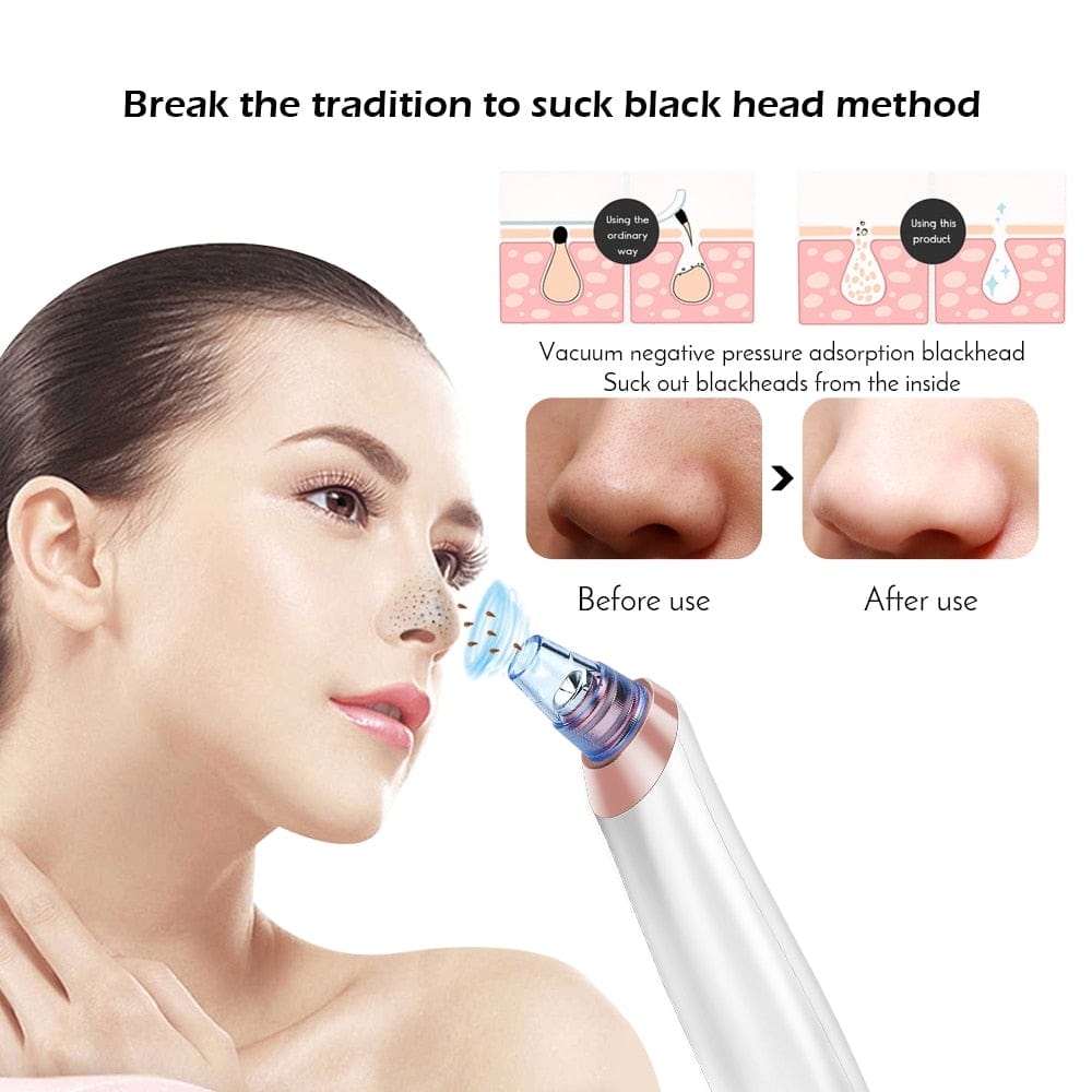 Face Nose Acne Black Dot Pimple Blackhead Remover Electric Blackhead Vacuum Cleaner Pore Blackhead Skin Care Tools Machine - WERBE-WELT.SHOP