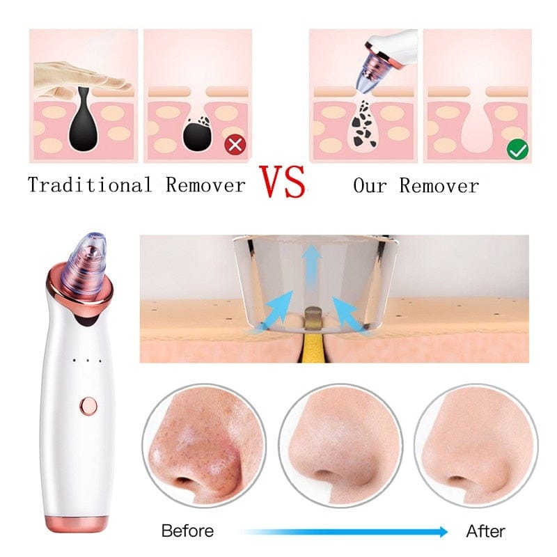 Facial Blackhead Remover Electric Acne Cleaner Blackhead Black Point Vacuum Cleaner Tool Black Spots Pore Cleaner Machine - WERBE-WELT.SHOP
